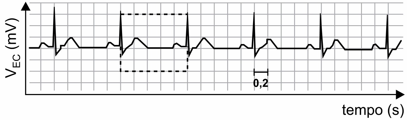 Eletrocardiograma em uma questão do Enem sobre ondas periódicas.