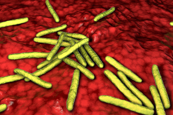 Cuidados em Casa - Conhecida popularmente como lepra, a hanseníase é uma  doença milenar, causada pela bactéria Mycobacterium Leprae e transmitida  principalmente por via respiratória. A doença, que tem cura, acomete pele