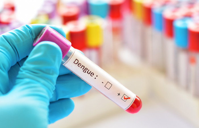 Exames laboratoriais são essenciais para a confirmação do diagnóstico da dengue.