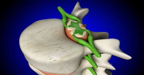 Medula espinhal ilustração representando medula espinhal