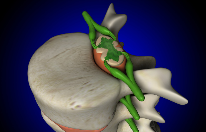  A coluna vertebral ajuda a proteger a medula espinhal.