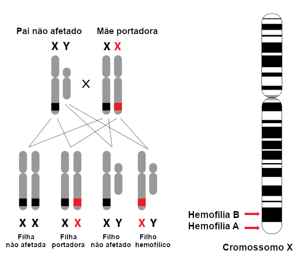 Observe que a presença de um gene afetado é suficiente para desencadear a hemofilia em homens.