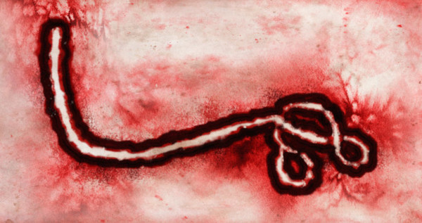 O vírus Ebola causa febre hemorrágica.