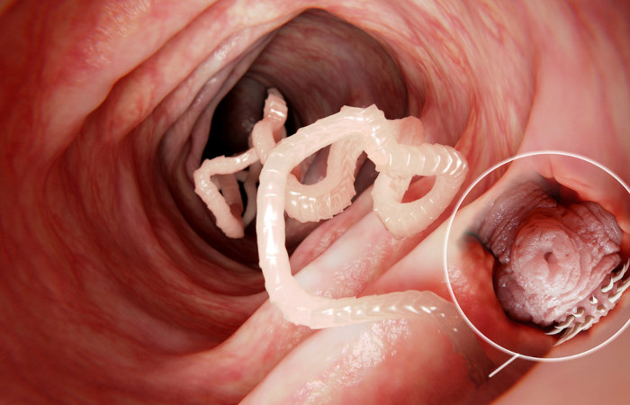 A tênia se fixa na mucosa intestinal por meio do escólex.