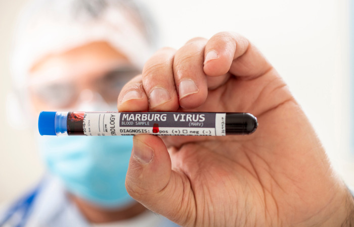 A doença do vírus de Marburg é provocada pelo vírus de Marburg, um vírus da mesma família do vírus causador do ebola.