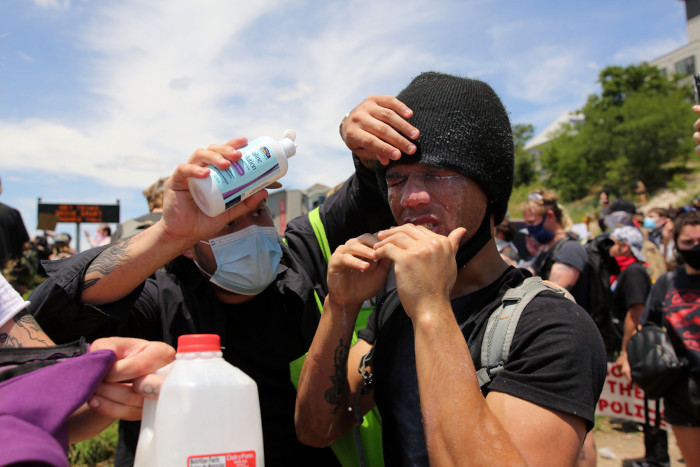 Pessoa atingida por gás lacrimogêneo lavando os olhos com solução de bicarbonato de sódio em um protesto nos Estados Unidos. [3]
