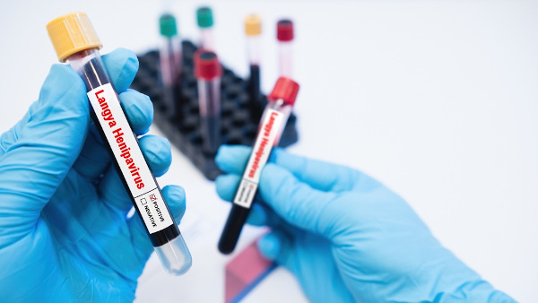 Pessoa da área da saúde segurando tubos de amostra de sangue que testaram positivo para Langya henipavirus.