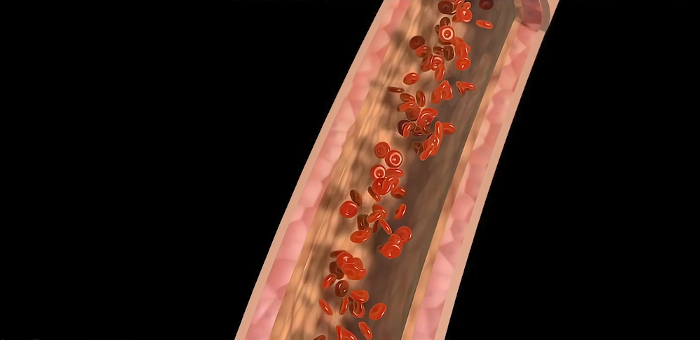 Representação gráfica de um vaso sanguíneo, no qual nitratos orgânicos são usados devido à sua função de expansão.