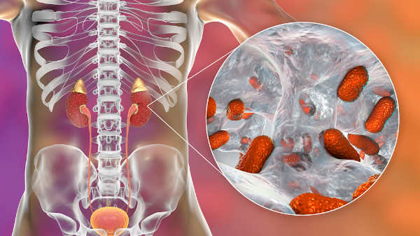Ilustração dos órgãos do trato urinário no corpo humano e bactérias nos rins, causa da pielonefrite.
