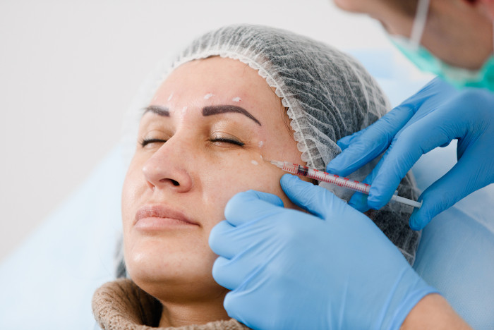 Mulher recebendo injeção de toxina botulínica, produzida pela Clostridium botulinum, na região do rosto.