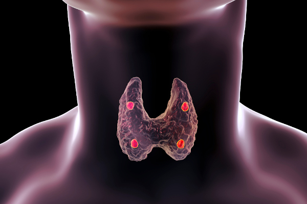 Ilustração 3D de um pescoço humano com quatro pontos vermelhos indicando a localização das glândulas paratireoides.