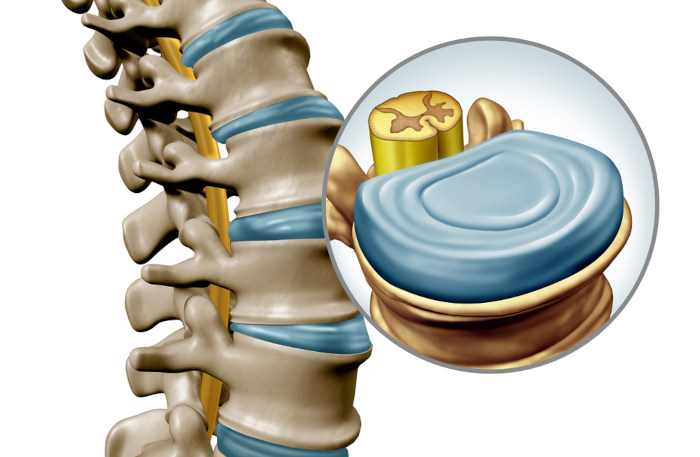 Ilustração do disco intervertebral, estrutura gelatinosa que se situa entre as vértebras da coluna vertebral.