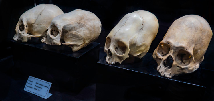Crânios modificados pelos incas em exposição no Museu Inca de Cusco.