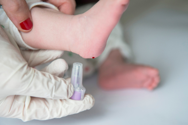 Enfermeira coletando o sangue do calcanhar de um bebê para fazer o teste do pezinho.