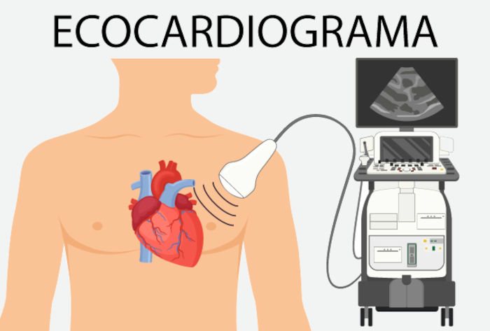 Ilustração representativa do ecocardiograma, que usa o ultrassom para analisar o coração.