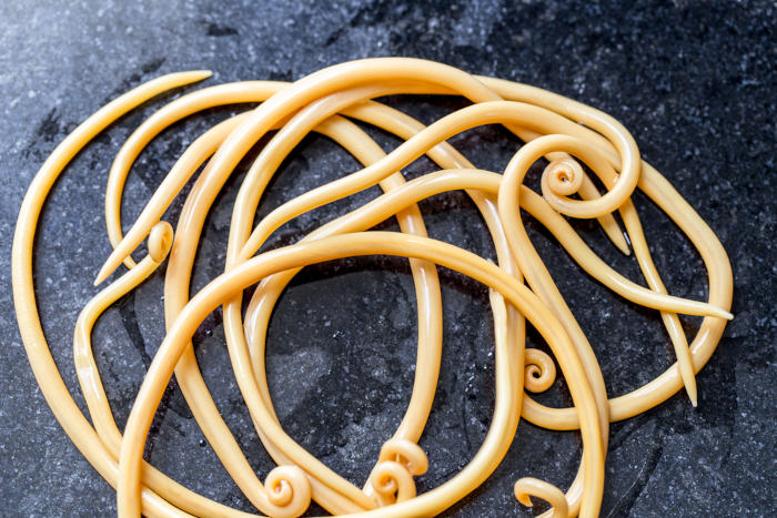 Vermes causadores da doença ascaridíase, conhecidos como lombrigas. [imagem_principal]