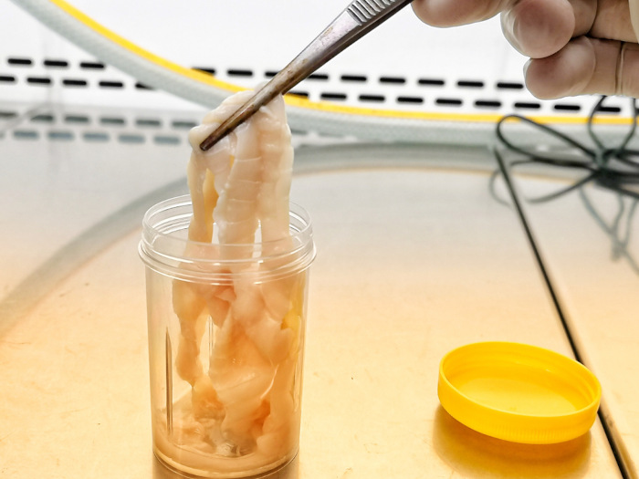 Vermes causadores da doença ascaridíase, conhecidos como lombrigas. [imagem_principal] Tênia sendo pinçada em laboratório, em texto sobre doenças causadas por vermes.