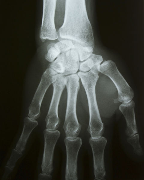 Radiografia de uma mão em texto sobre espectro eletromagnético.