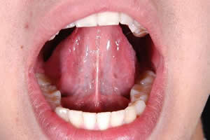 O frênulo liga a língua ao assoalho da boca. 
