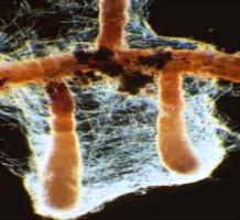 Micorriza: associação entre fungos e raízes de vegetais superiores.