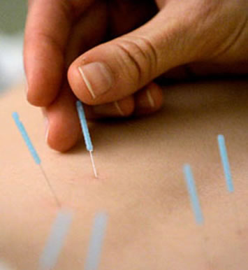 A acupuntura é muito utilizada no tratamento de doenças em humanos e também em animais