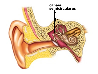 A labirintite afeta o labirinto, uma região que fica dentro do ouvido e é essencial ao equilíbrio do nosso corpo