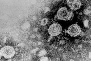 HBV: vírus responsável pela hepatite B. 
