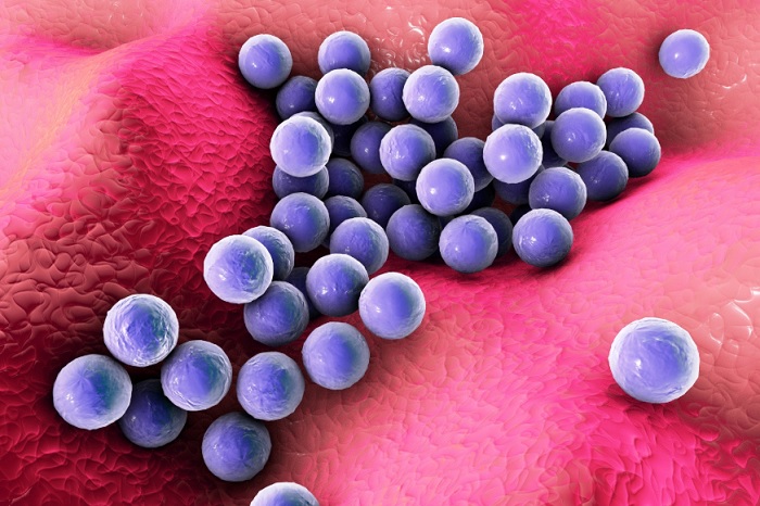 Staphylococcus aureus pode ter relação com o desenvolvimento da fasciíte necrosante