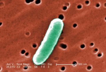 Imagem de uma Escherichia coli  em microscopia eletrônica de varredura. Escala: 500nm.