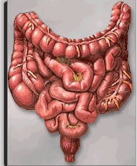 A Síndrome do Intestino Irritável acomete mais mulheres jovens