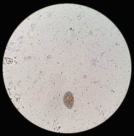 Observe o ovo de Diphyllobothrium, o causador da “tênia do peixe”