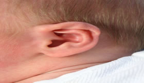 A cera só deve ser removida quando estiver na parte externa do ouvido.