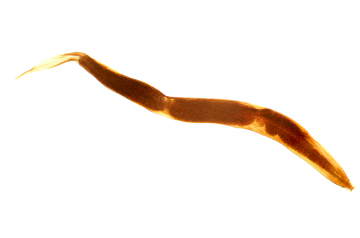 O parasito Enterobius vermicularis é o causador da oxiuríase ou enterobíase