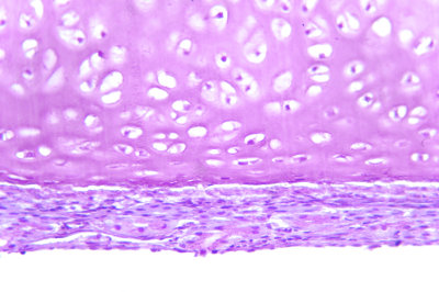 O tecido cartilaginoso é um tipo de tecido conjuntivo