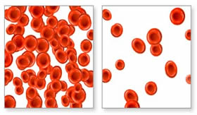 A redução de glóbulos vermelhos