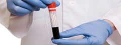 Muitas doenças podem ser diagnosticadas pela análise sanguínea do paciente.