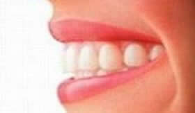 Uma pessoa adulta geralmente possui 32 dentes