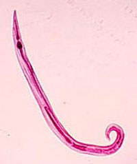 Trichuris trichiura é o verme causador da tricocefaliase