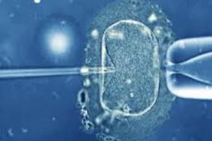 Na ICSI, um espermatozoide é injetado diretamente em um ovócito.