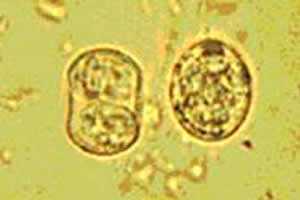 Cistos do Toxoplasma gondii. 